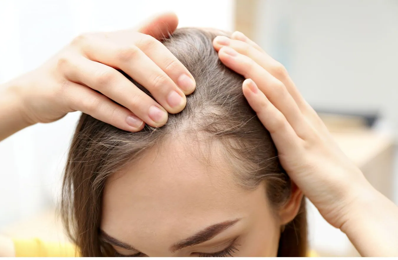 Mesohair-Behandlung der Kopfhaut